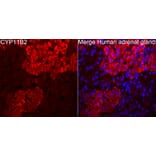 Immunofluorescence - Anti-CYP11B2 Antibody (A329300) - Antibodies.com