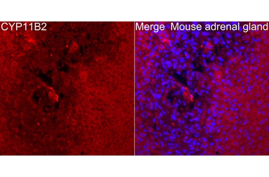 Immunofluorescence - Anti-CYP11B2 Antibody (A329300) - Antibodies.com