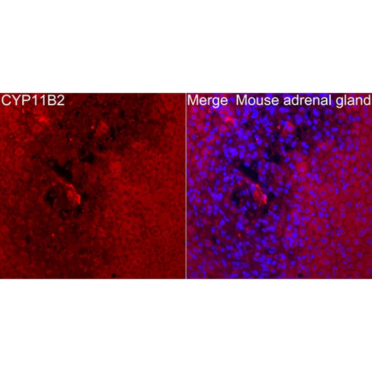 Immunofluorescence - Anti-CYP11B2 Antibody (A329300) - Antibodies.com