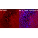 Immunofluorescence - Anti-CYP11B2 Antibody (A329300) - Antibodies.com