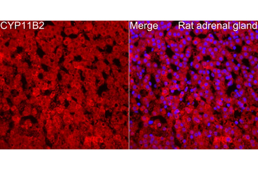 Immunofluorescence - Anti-CYP11B2 Antibody (A329300) - Antibodies.com