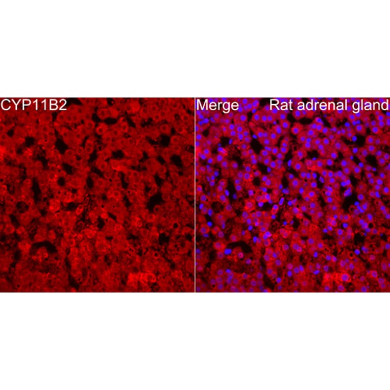Immunofluorescence - Anti-CYP11B2 Antibody (A329300) - Antibodies.com