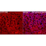 Immunofluorescence - Anti-CYP11B2 Antibody (A329300) - Antibodies.com