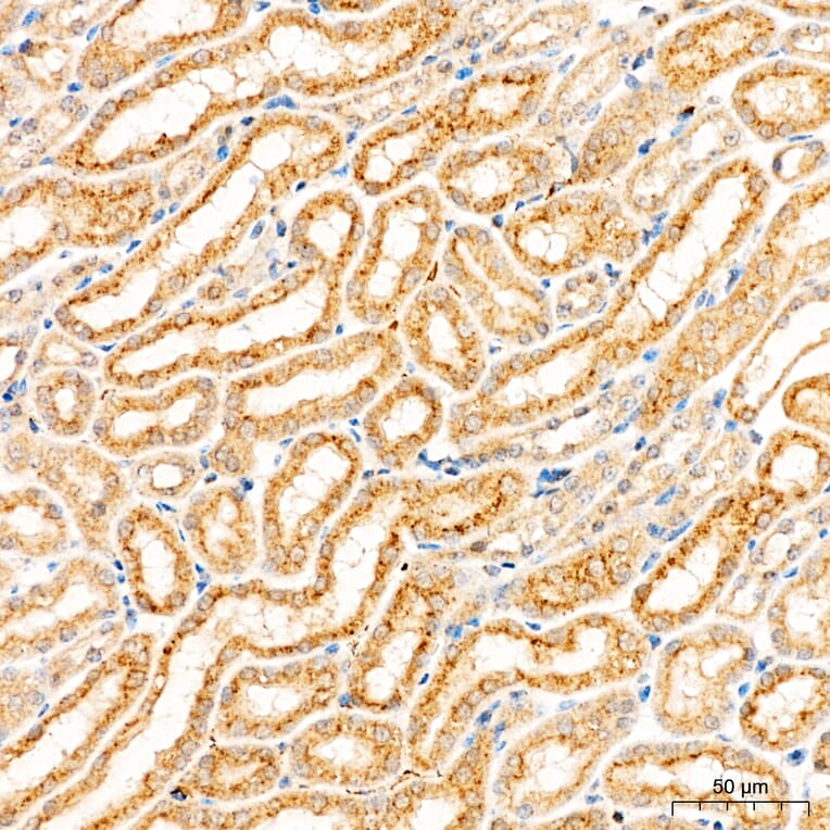 Immunohistochemistry - Anti-CYP1A1 Antibody (A329301) - Antibodies.com