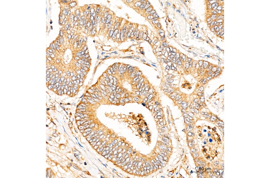 Immunohistochemistry - Anti-CYP1A1 Antibody (A329301) - Antibodies.com