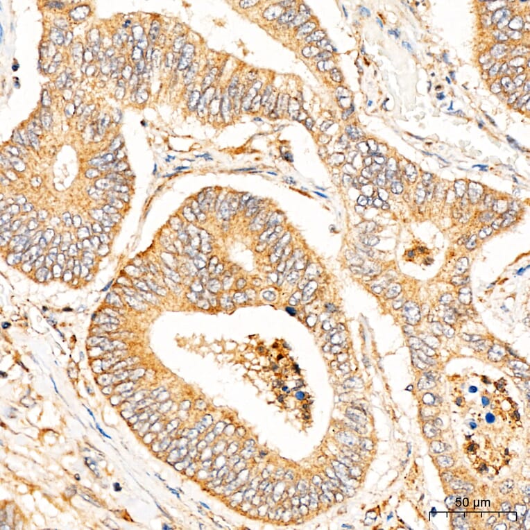 Immunohistochemistry - Anti-CYP1A1 Antibody (A329301) - Antibodies.com