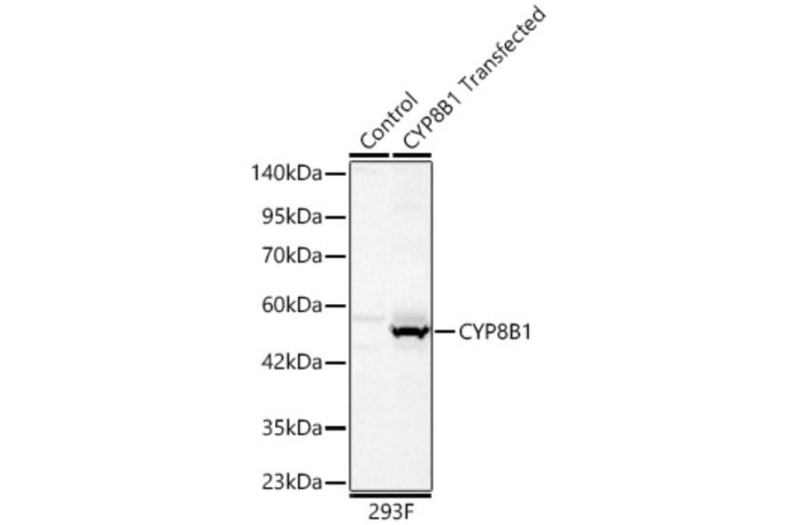 Western Blot - Anti-CYP8B1 Antibody (A329303) - Antibodies.com
