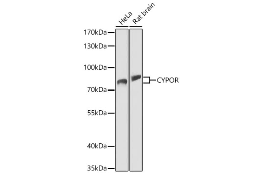 Western Blot - Anti-Cytochrome P450 Reductase Antibody (A329304) - Antibodies.com