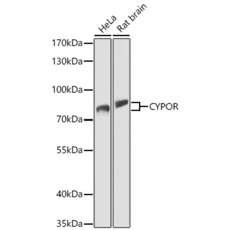 Western Blot - Anti-Cytochrome P450 Reductase Antibody (A329304) - Antibodies.com