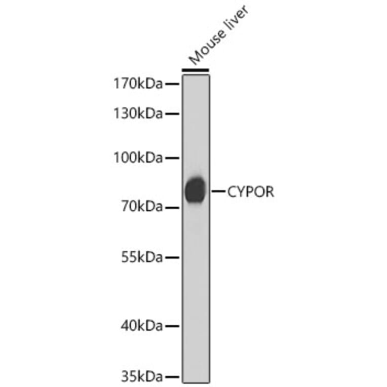 Western Blot - Anti-Cytochrome P450 Reductase Antibody (A329304) - Antibodies.com