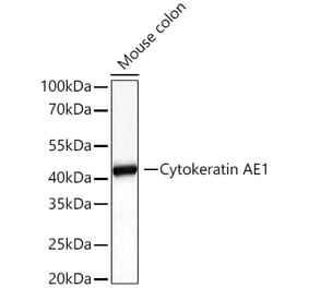 Western Blot - Anti-Cytokeratin 10 Antibody (A329305) - Antibodies.com