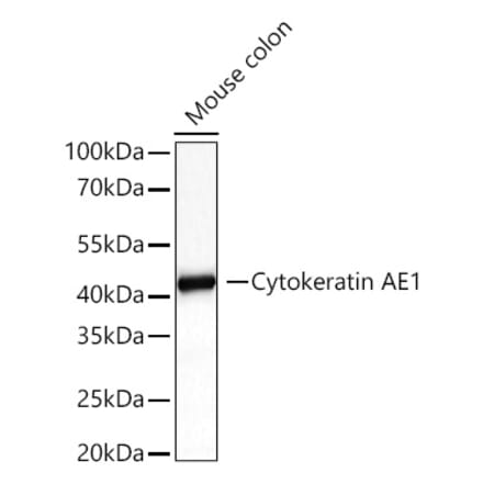 Western Blot - Anti-Cytokeratin 10 Antibody (A329305) - Antibodies.com