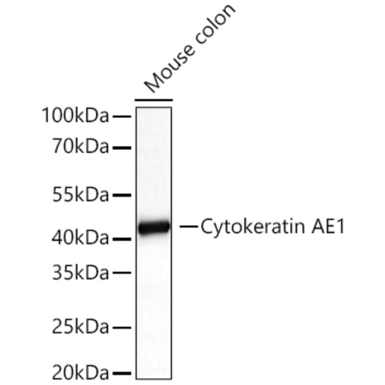 Western Blot - Anti-Cytokeratin 10 Antibody (A329305) - Antibodies.com