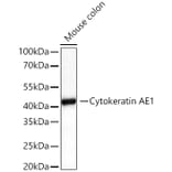 Western Blot - Anti-Cytokeratin 10 Antibody (A329305) - Antibodies.com