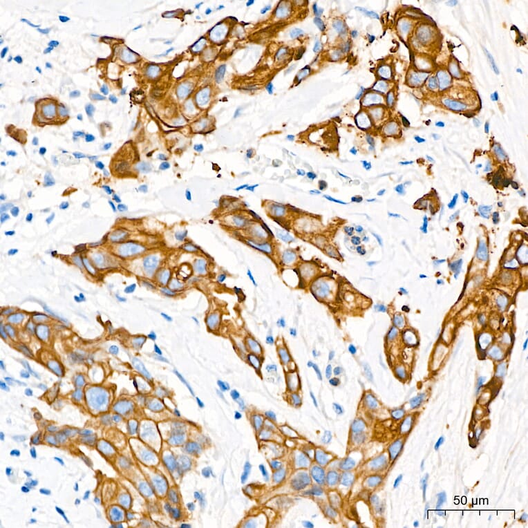 Immunohistochemistry - Anti-Cytokeratin 10 Antibody (A329305) - Antibodies.com