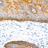 Immunohistochemistry - Anti-Cytokeratin 10 Antibody (A329305) - Antibodies.com