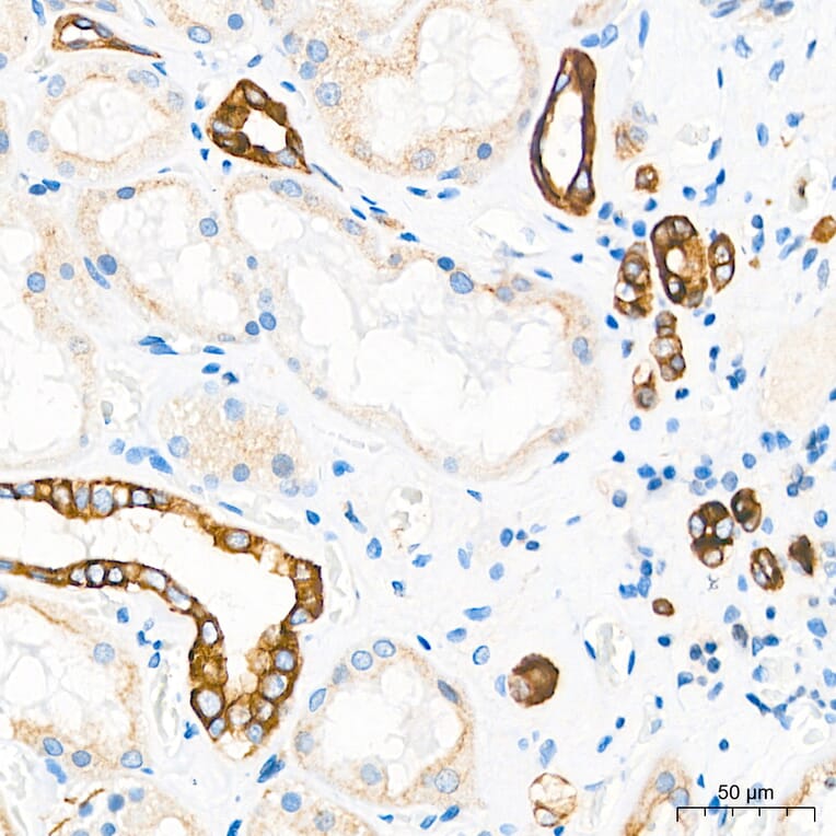 Immunohistochemistry - Anti-Cytokeratin 10 Antibody (A329305) - Antibodies.com