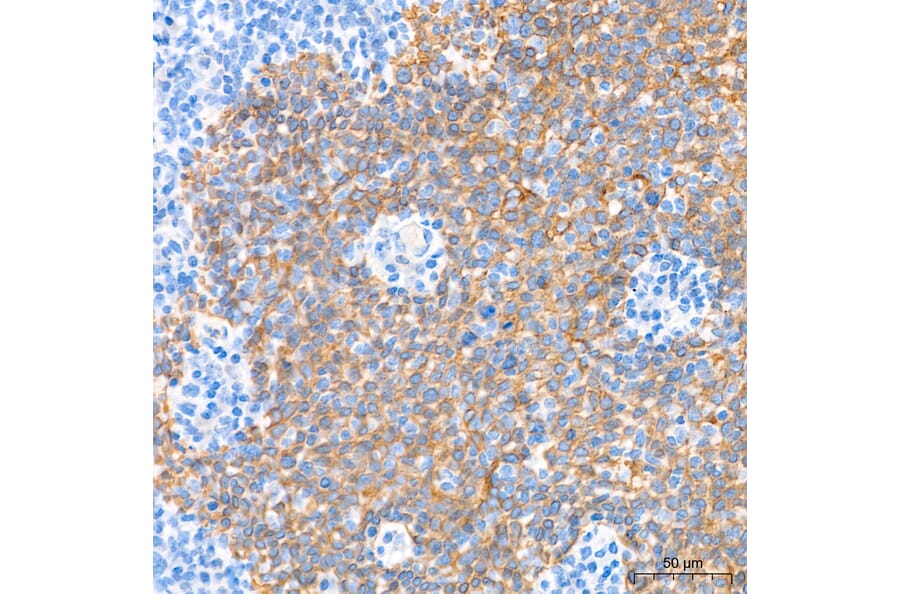 Immunohistochemistry - Anti-Cytokeratin 10 Antibody (A329305) - Antibodies.com