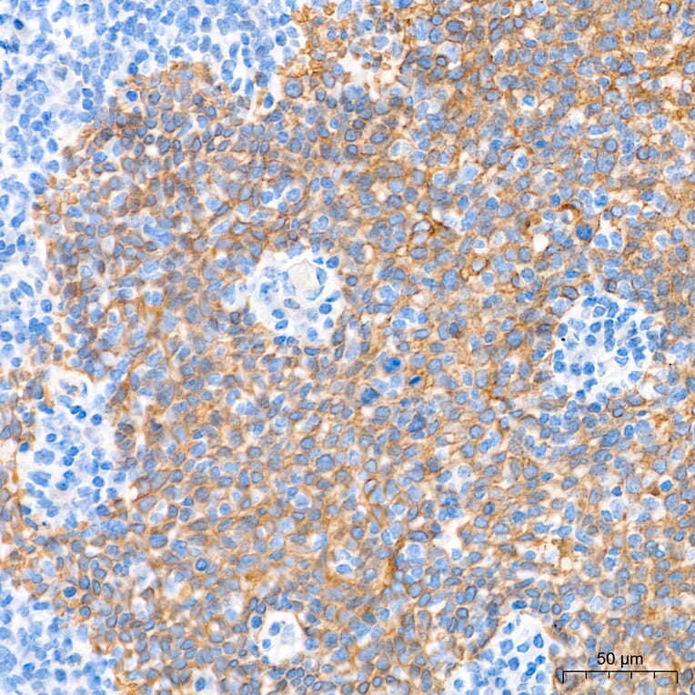 Immunohistochemistry - Anti-Cytokeratin 10 Antibody (A329305) - Antibodies.com