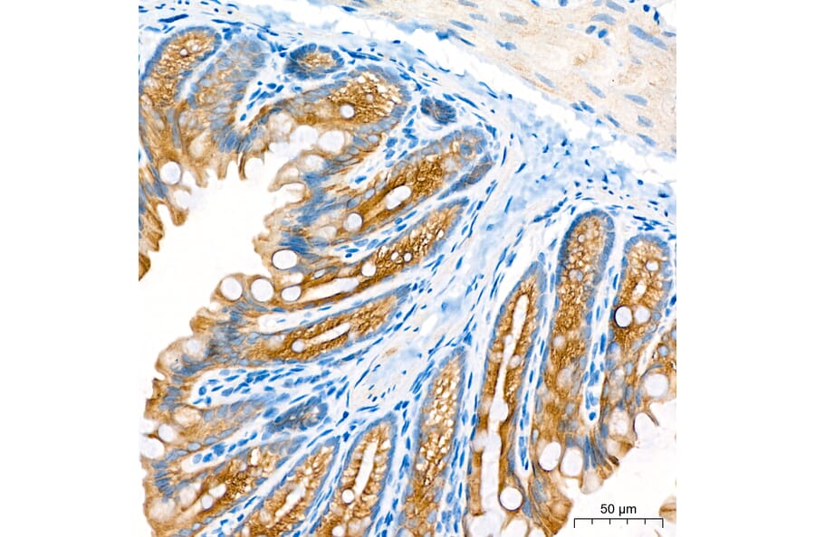 Immunohistochemistry - Anti-Cytokeratin 10 Antibody (A329305) - Antibodies.com