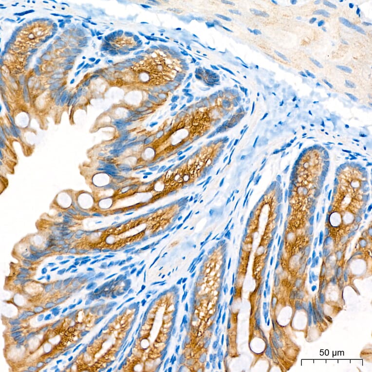 Immunohistochemistry - Anti-Cytokeratin 10 Antibody (A329305) - Antibodies.com