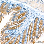 Immunohistochemistry - Anti-Cytokeratin 10 Antibody (A329305) - Antibodies.com