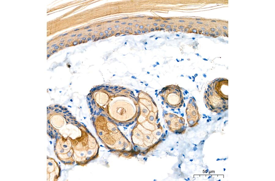 Immunohistochemistry - Anti-Cytokeratin 10 Antibody (A329305) - Antibodies.com