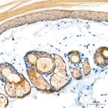 Immunohistochemistry - Anti-Cytokeratin 10 Antibody (A329305) - Antibodies.com