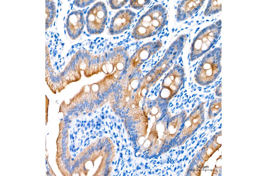 Immunohistochemistry - Anti-Cytokeratin 10 Antibody (A329305) - Antibodies.com