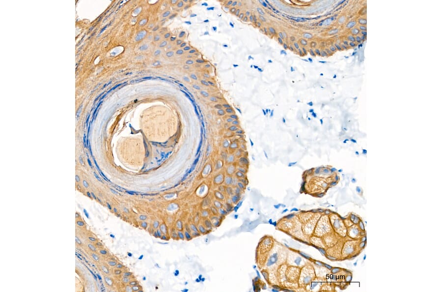 Immunohistochemistry - Anti-Cytokeratin 10 Antibody (A329305) - Antibodies.com