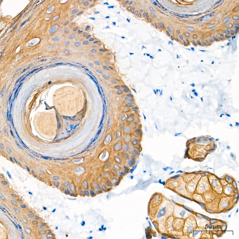Immunohistochemistry - Anti-Cytokeratin 10 Antibody (A329305) - Antibodies.com