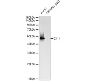 Western Blot - Anti-Cytokeratin 14 Antibody (A329306) - Antibodies.com