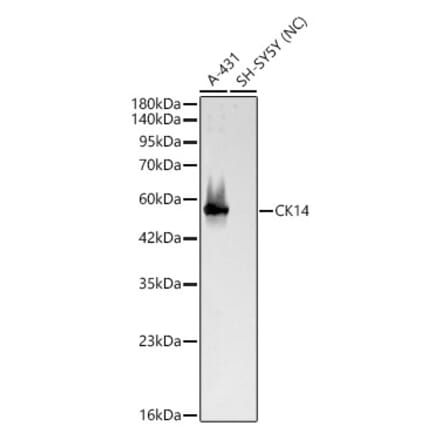 Western Blot - Anti-Cytokeratin 14 Antibody (A329306) - Antibodies.com