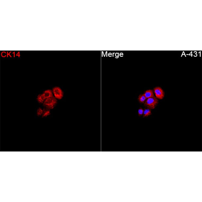 Immunofluorescence - Anti-Cytokeratin 14 Antibody (A329306) - Antibodies.com