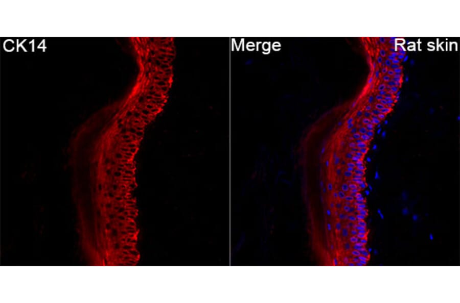 Immunofluorescence - Anti-Cytokeratin 14 Antibody (A329306) - Antibodies.com