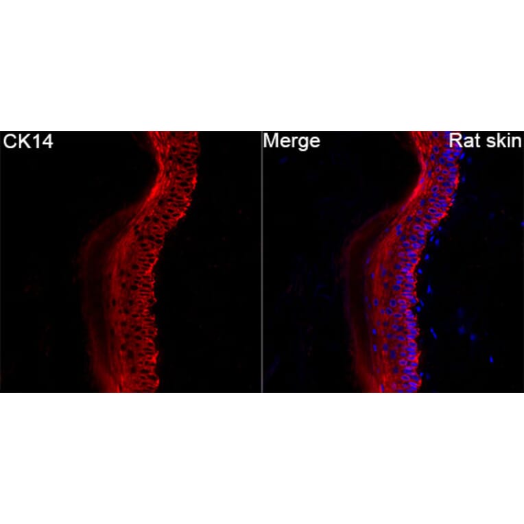 Immunofluorescence - Anti-Cytokeratin 14 Antibody (A329306) - Antibodies.com