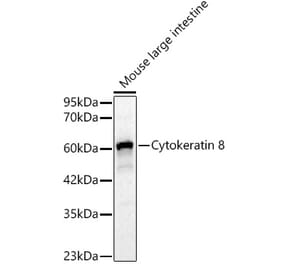 Western Blot - Anti-Cytokeratin 8 Antibody (A329307) - Antibodies.com