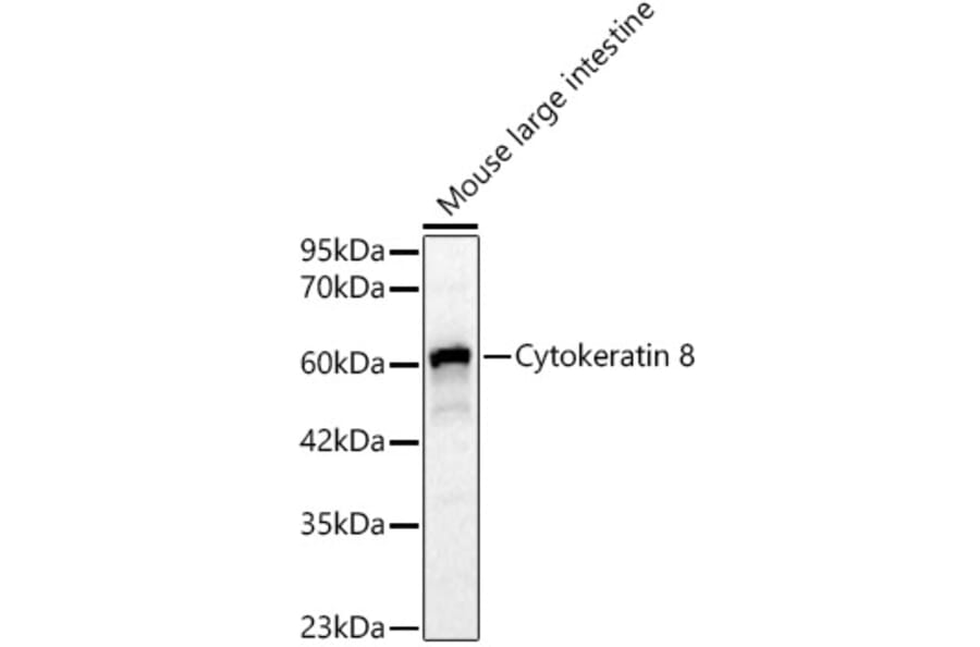 Western Blot - Anti-Cytokeratin 8 Antibody (A329307) - Antibodies.com