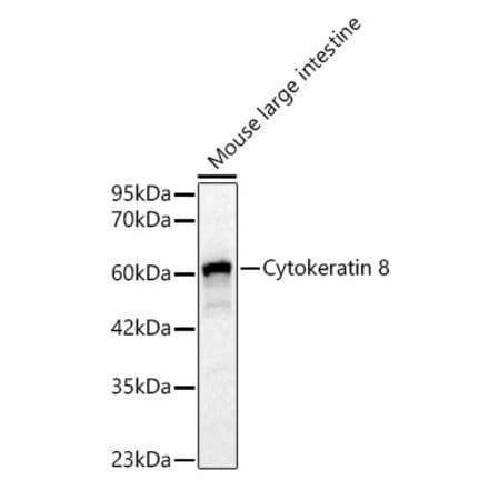 Western Blot - Anti-Cytokeratin 8 Antibody (A329307) - Antibodies.com