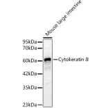 Western Blot - Anti-Cytokeratin 8 Antibody (A329307) - Antibodies.com