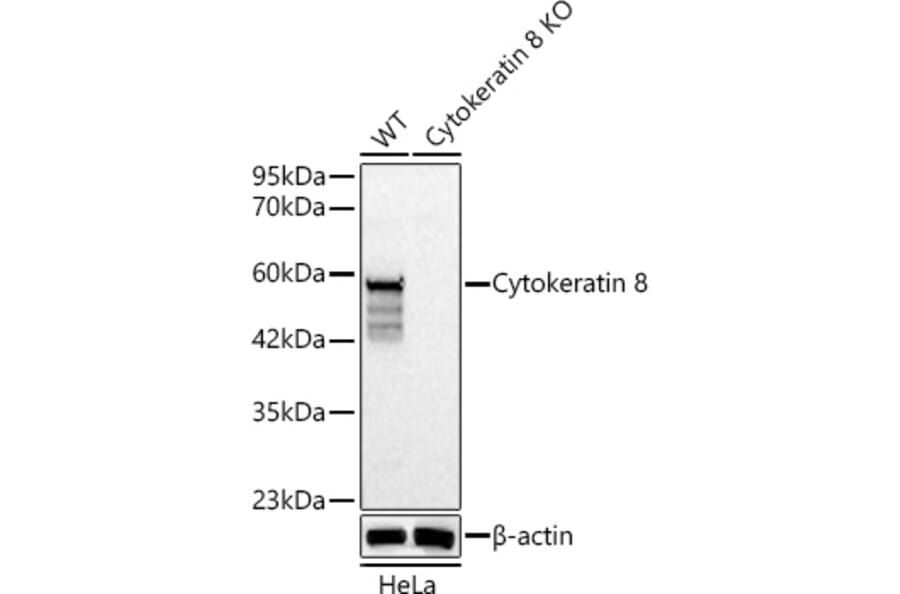 Western Blot - Anti-Cytokeratin 8 Antibody (A329307) - Antibodies.com
