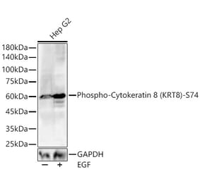 Western Blot - Anti-Cytokeratin 8 (Phospho S74) Antibody (A329308) - Antibodies.com
