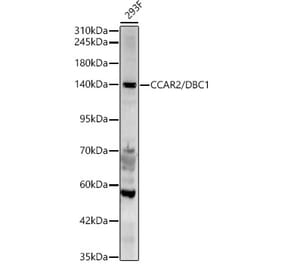 Western Blot - Anti-DBC-1 Antibody (A329309) - Antibodies.com