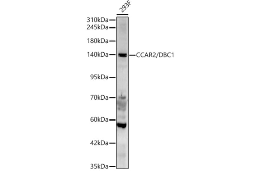 Western Blot - Anti-DBC-1 Antibody (A329309) - Antibodies.com