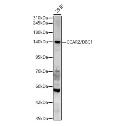 Western Blot - Anti-DBC-1 Antibody (A329309) - Antibodies.com