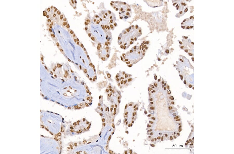 Immunohistochemistry - Anti-DBC-1 Antibody (A329309) - Antibodies.com