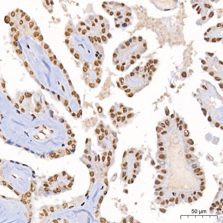 Immunohistochemistry - Anti-DBC-1 Antibody (A329309) - Antibodies.com