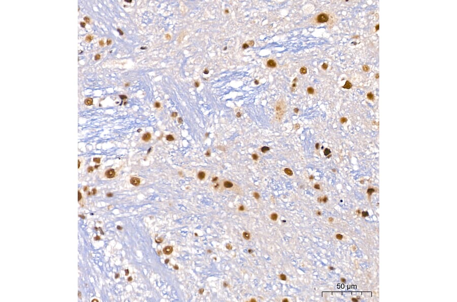 Immunohistochemistry - Anti-DBC-1 Antibody (A329309) - Antibodies.com