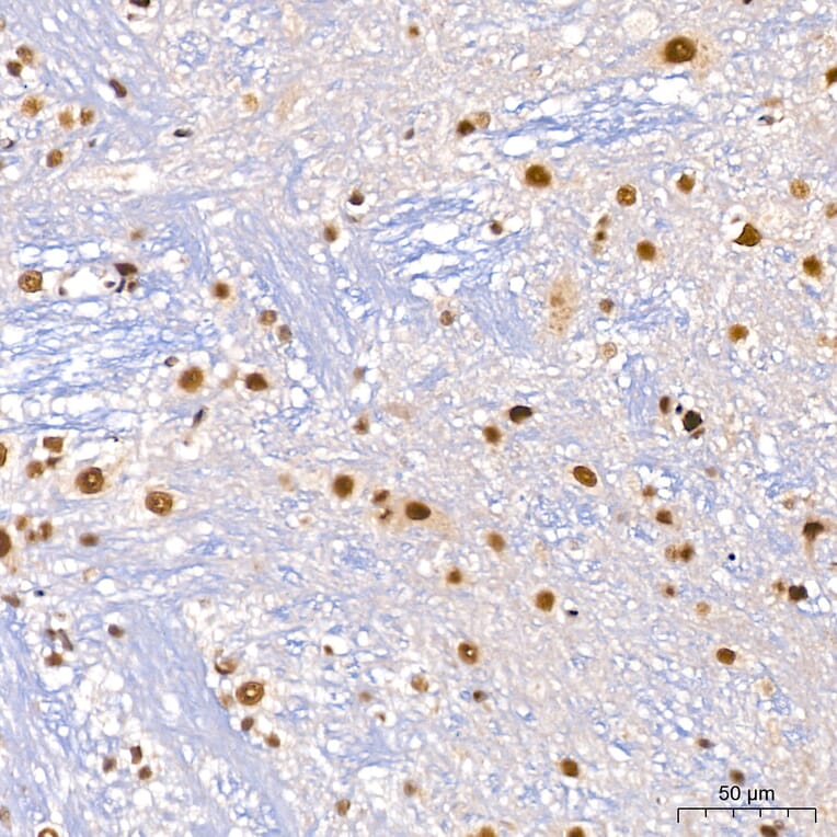Immunohistochemistry - Anti-DBC-1 Antibody (A329309) - Antibodies.com