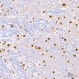 Immunohistochemistry - Anti-DBC-1 Antibody (A329309) - Antibodies.com
